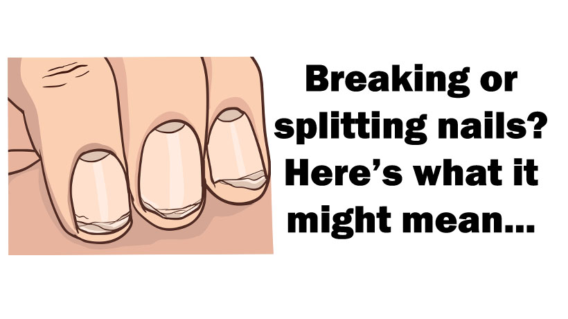 Brittle Nails: What that might mean to the body - WomenWorking