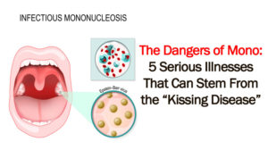 The Dangers of Mono: 5 Serious Illnesses That Can Stem From the ...