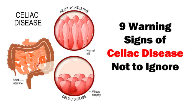 Can A Baby Develop Properly If Mother Has Undiagnosed Celiac?