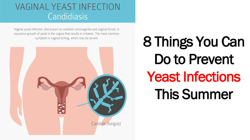 Prevent Yeast Infections