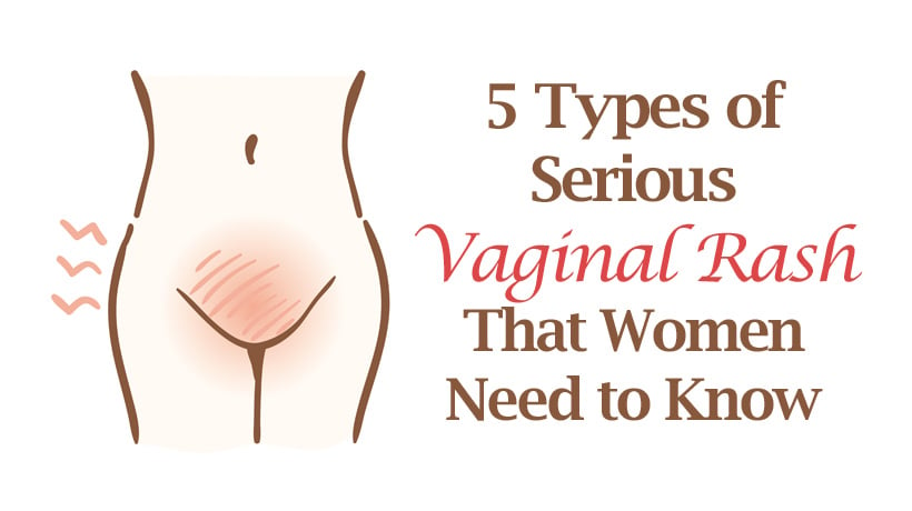 Of vaginas types The Top