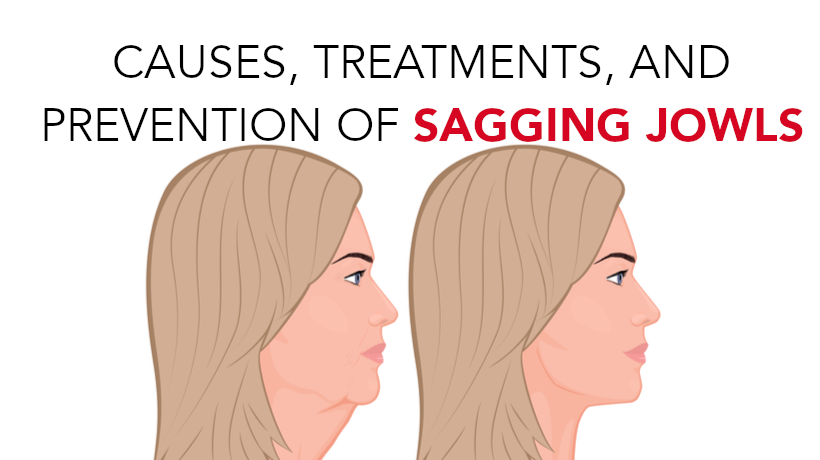 Causes Treatments Prevention Of Sagging Jowls Womenworking